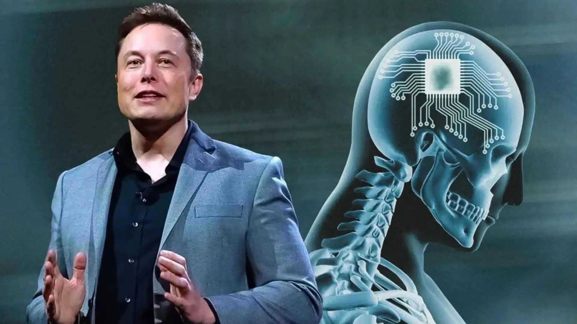 Neuralink, Beyin İmplantını İnsanlar Üzerinde Test Etmek İçin FDA Onayını Aldı.